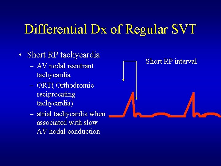 Differential Dx of Regular SVT • Short RP tachycardia – AV nodal reentrant tachycardia Differential Dx of Regular SVT • Short RP tachycardia – AV nodal reentrant tachycardia