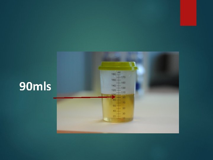 90 mls 90 mls