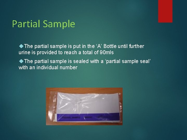 Partial Sample The partial sample is put in the ‘A’ Bottle until further urine Partial Sample The partial sample is put in the ‘A’ Bottle until further urine