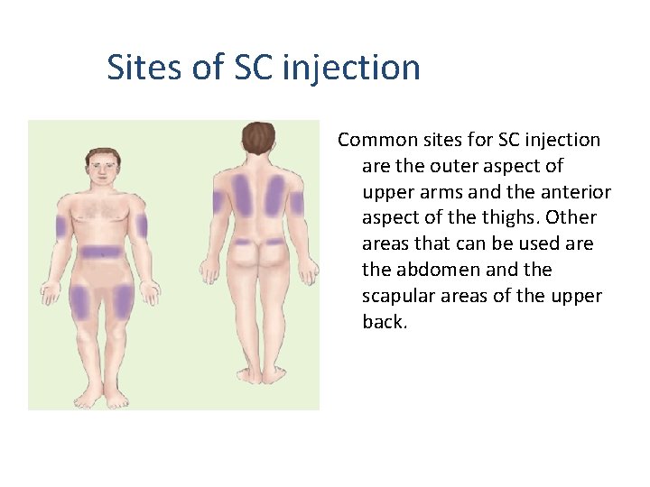 Sites of SC injection Common sites for SC injection are the outer aspect of