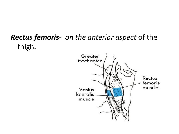  Rectus femoris- on the anterior aspect of the thigh. 