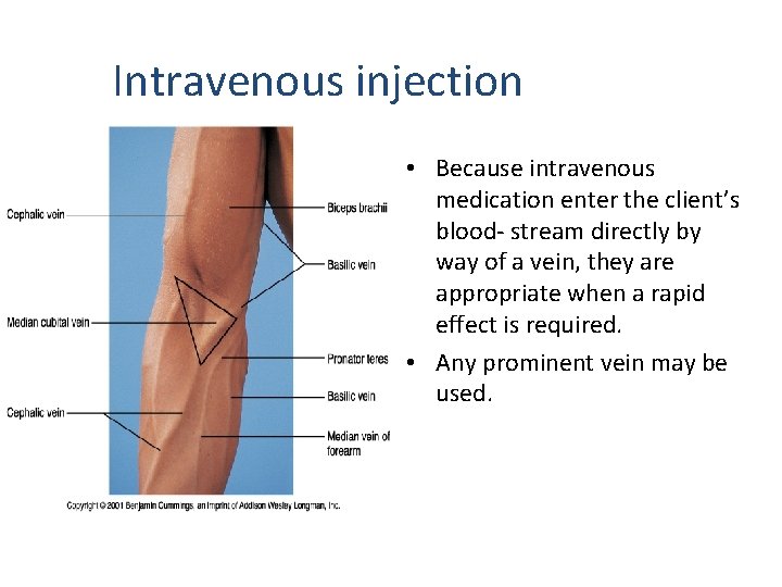 Intravenous injection • Because intravenous medication enter the client’s blood- stream directly by way