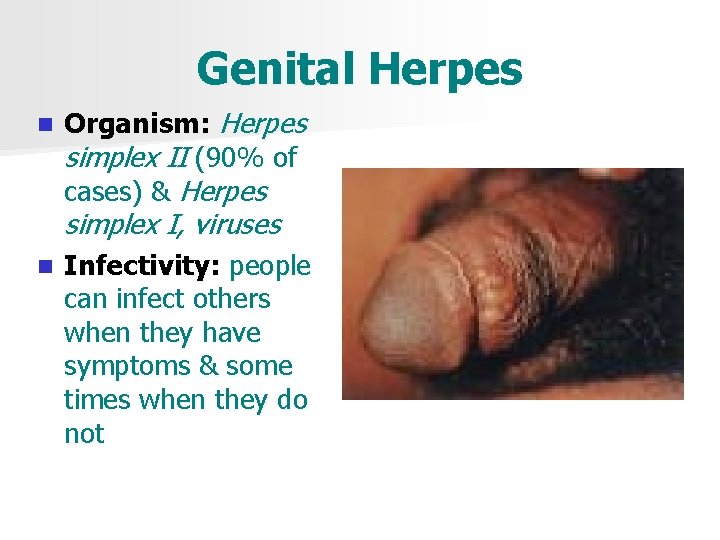 Genital Herpes n Organism: Herpes simplex II (90% of cases) & Herpes simplex I,