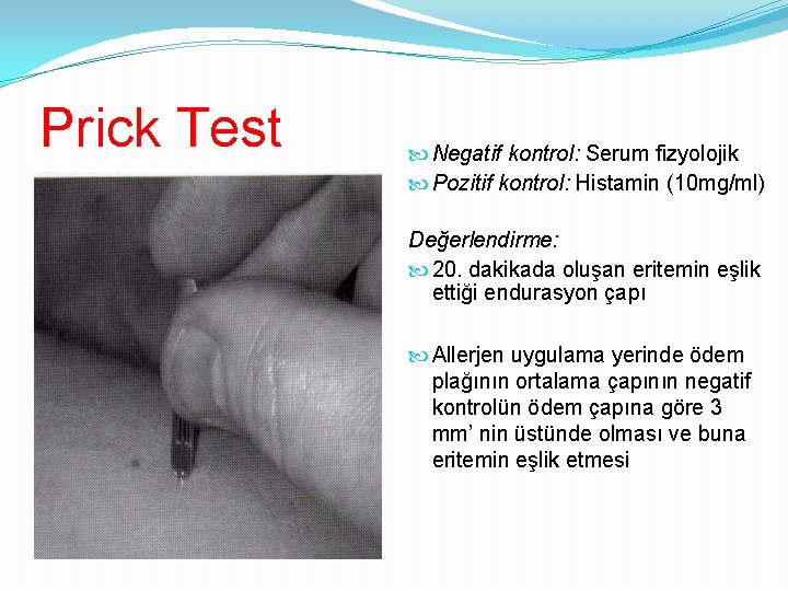 Prick Test Negatif kontrol: Serum fizyolojik Pozitif kontrol: Histamin (10 mg/ml) Değerlendirme: 20. dakikada
