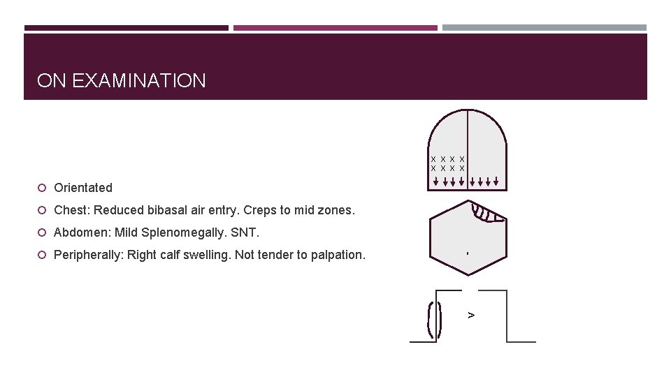 ON EXAMINATION X X X X Orientated Chest: Reduced bibasal air entry. Creps to