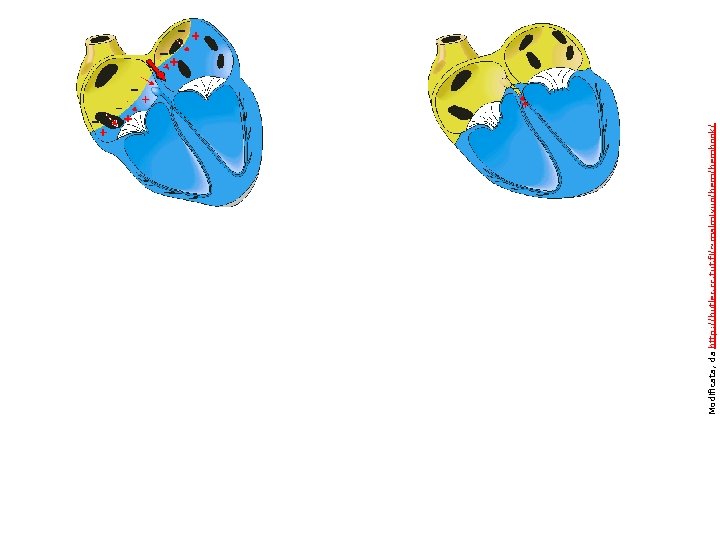 Modificata, da http: //butler. cc. tut. fi/~malmivuo/bembook/ 