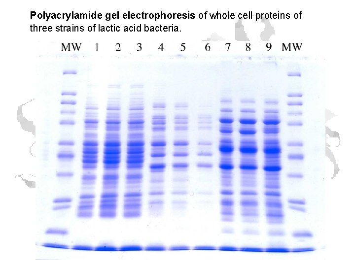 Polyacrylamide gel electrophoresis of whole cell proteins of three strains of lactic acid bacteria.