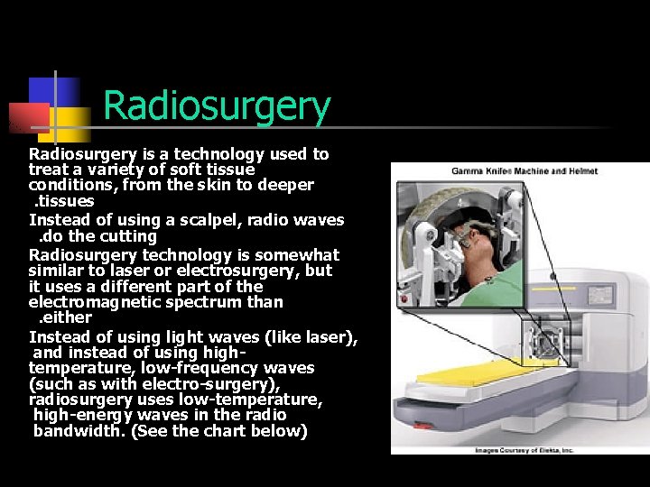 Radiosurgery is a technology used to treat a variety of soft tissue conditions, from