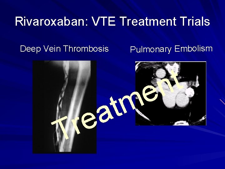 Rivaroxaban: VTE Treatment Trials Deep Vein Thrombosis Pulmonary Embolism r T m t a