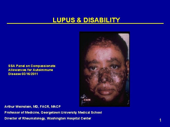 LUPUS & DISABILITY SSA Panel on Compassionate Allowances for Autoimmune Disease 03/16/2011 Arthur Weinstein,