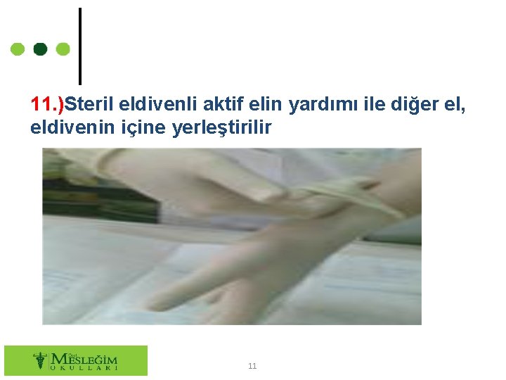 11. )Steril eldivenli aktif elin yardımı ile diğer el, eldivenin içine yerleştirilir 11 