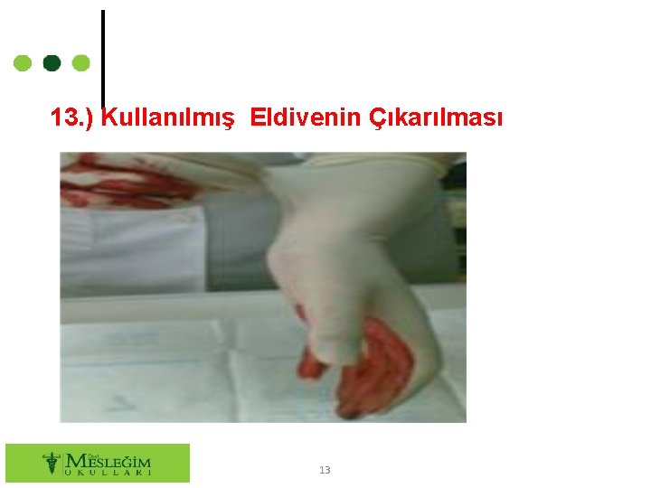 13. ) Kullanılmış Eldivenin Çıkarılması 13 