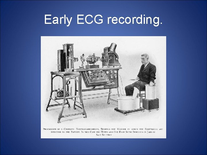 Early ECG recording. 