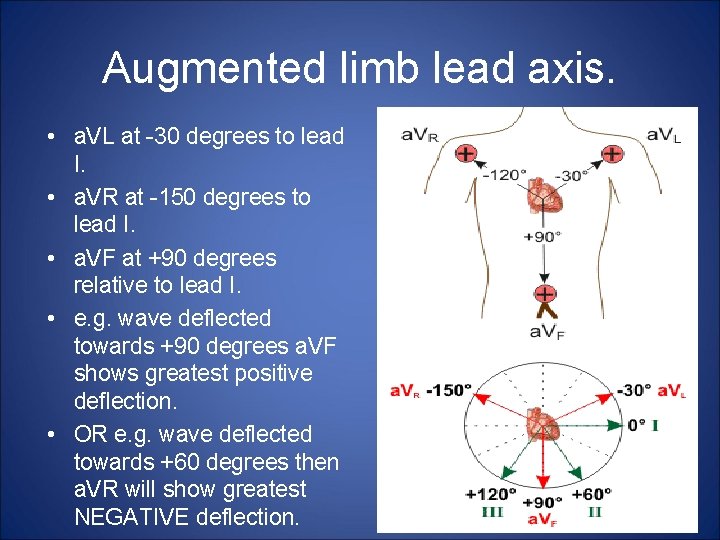 Augmented limb lead axis. • a. VL at -30 degrees to lead I. •