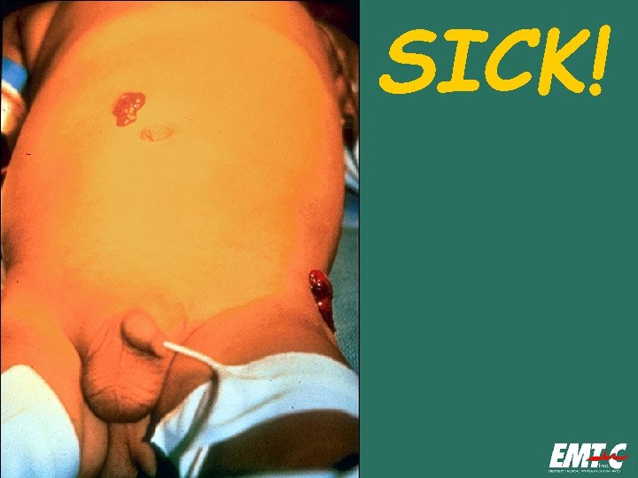 SICK! SICK!