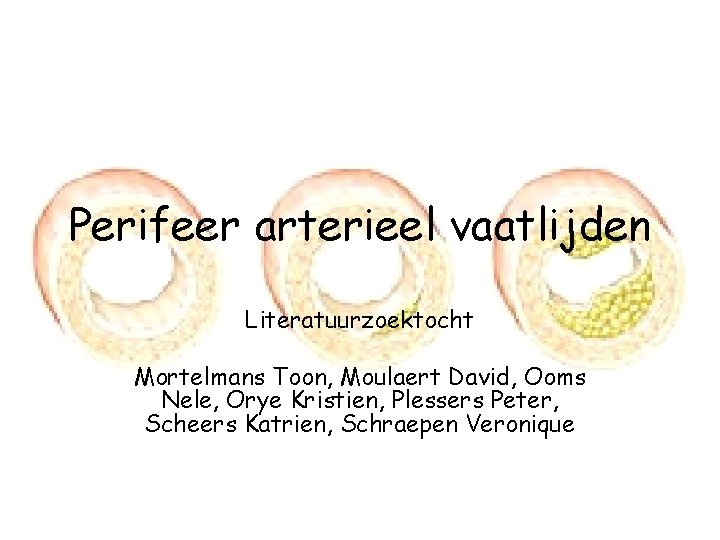 Perifeer arterieel vaatlijden Literatuurzoektocht Mortelmans Toon, Moulaert David, Ooms Nele, Orye Kristien, Plessers Peter,