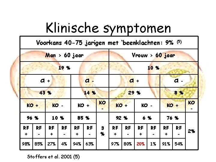 Klinische symptomen Voorkans 40 -75 jarigen met ‘beenklachten: 9% Man > 60 jaar Vrouw