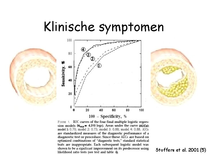 Klinische symptomen Stoffers et al. 2001 (5) 