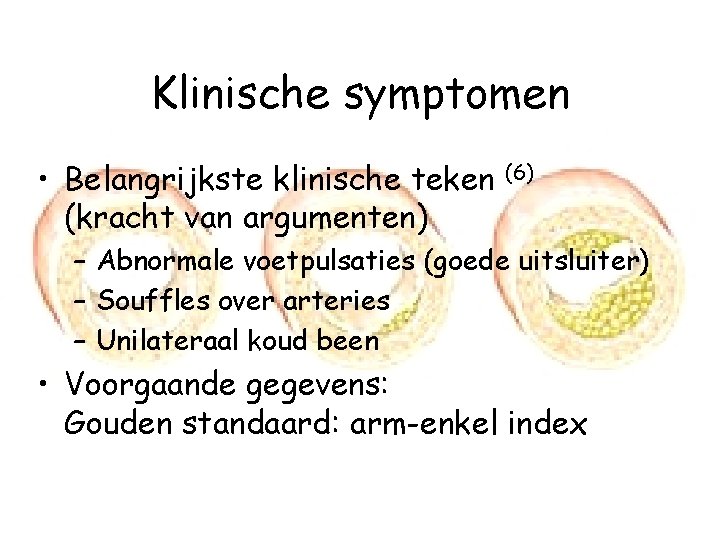 Klinische symptomen • Belangrijkste klinische teken (kracht van argumenten) (6) – Abnormale voetpulsaties (goede