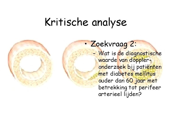 Kritische analyse • Zoekvraag 2: – Wat is de diagnostische waarde van doppleronderzoek bij