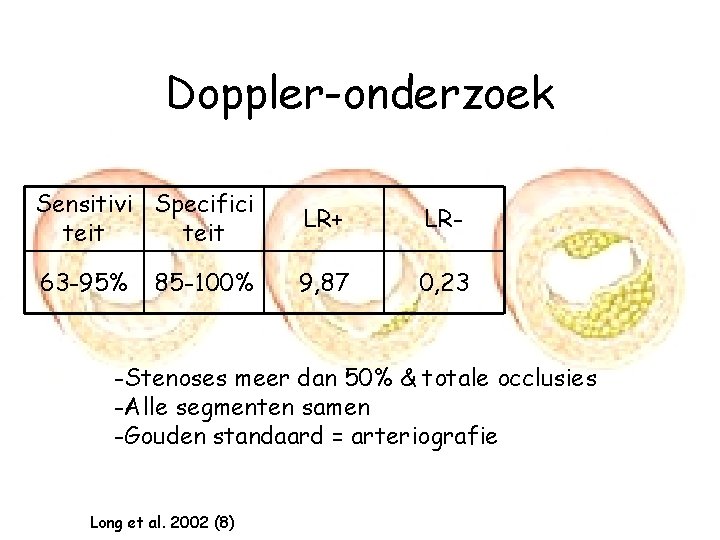 Doppler-onderzoek Sensitivi Specifici teit LR+ LR- 63 -95% 9, 87 0, 23 85 -100%