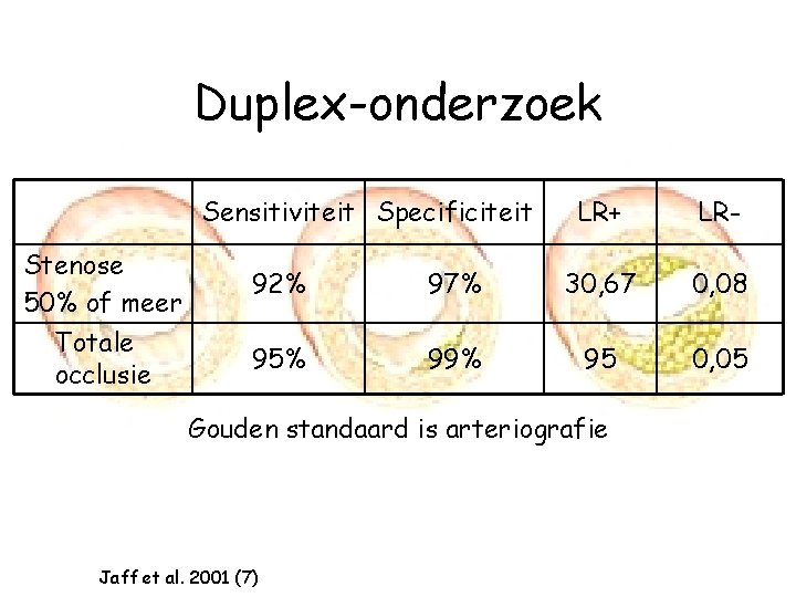 Duplex-onderzoek Sensitiviteit Specificiteit LR+ LR- Stenose 50% of meer 92% 97% 30, 67 0,