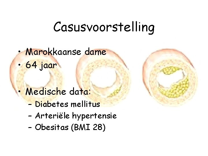 Casusvoorstelling • Marokkaanse dame • 64 jaar • Medische data: – Diabetes mellitus –