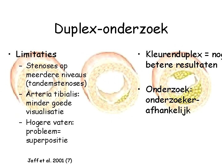 Duplex-onderzoek • Limitaties – Stenoses op meerdere niveaus (tandemstenoses) – Arteria tibialis: minder goede