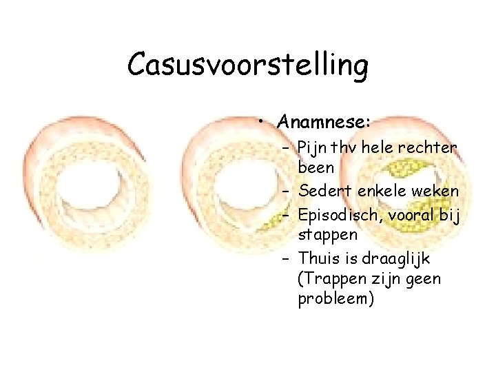 Casusvoorstelling • Anamnese: – Pijn thv hele rechter been – Sedert enkele weken –