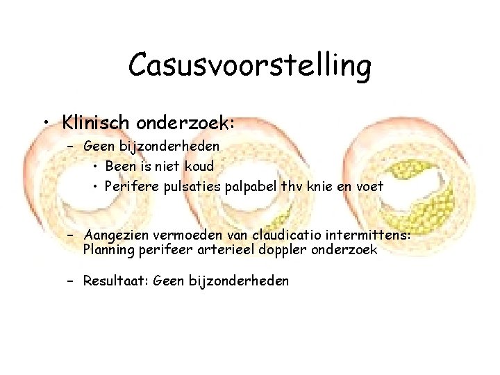 Casusvoorstelling • Klinisch onderzoek: – Geen bijzonderheden • Been is niet koud • Perifere