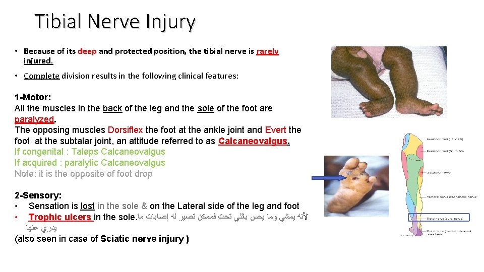 Tibial Nerve Injury • Because of its deep and protected position, the tibial nerve