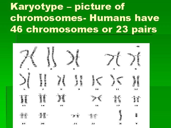 Karyotype – picture of chromosomes- Humans have 46 chromosomes or 23 pairs 