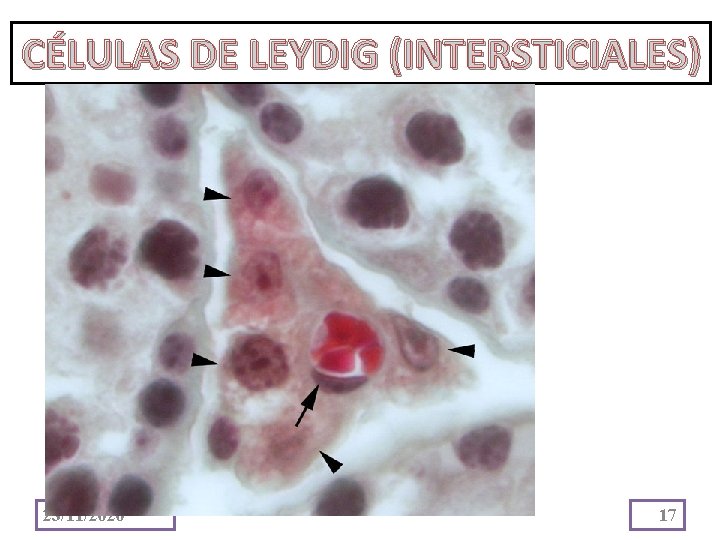 CÉLULAS DE LEYDIG (INTERSTICIALES) 23/11/2020 17 