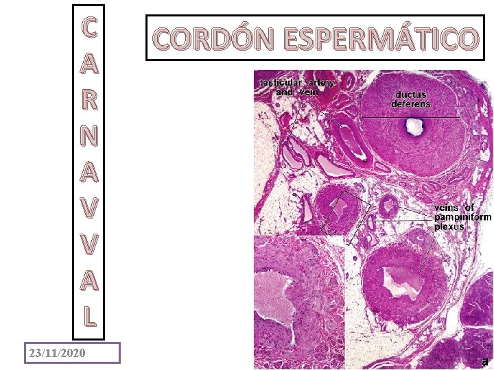 C A R N A V V A L 23/11/2020 CORDÓN ESPERMÁTICO 25 