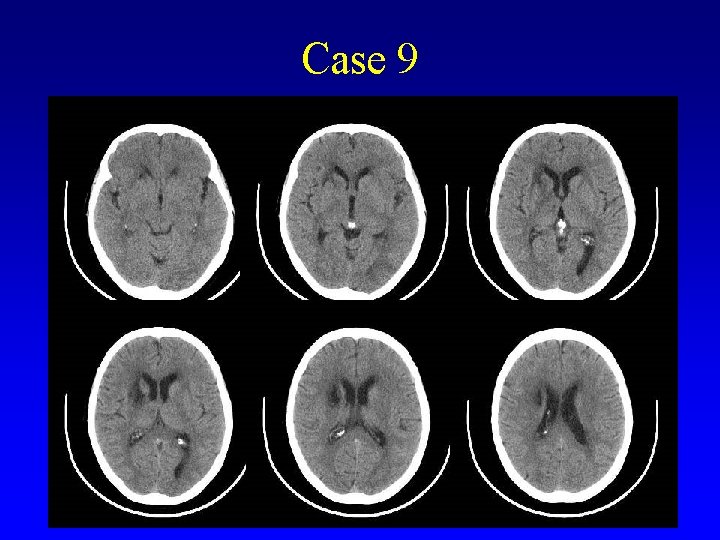 Case 9 