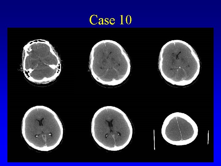 Case 10 