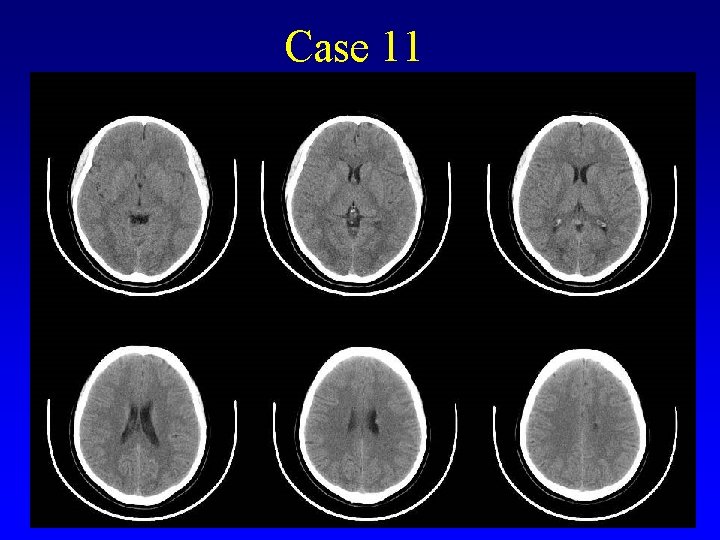 Case 11 