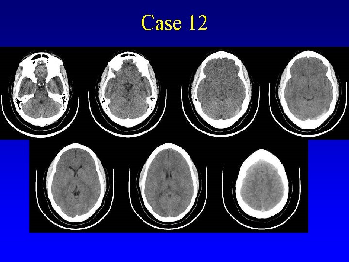 Case 12 