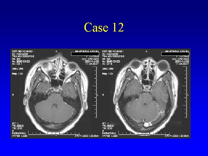 Case 12 