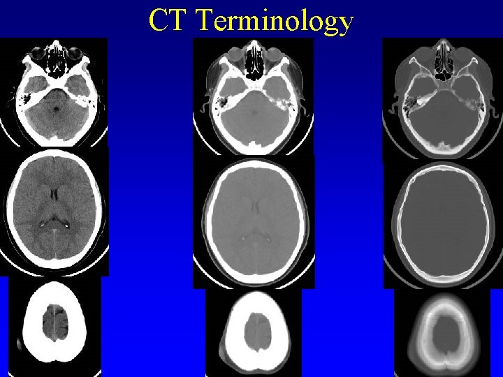 CT Terminology 