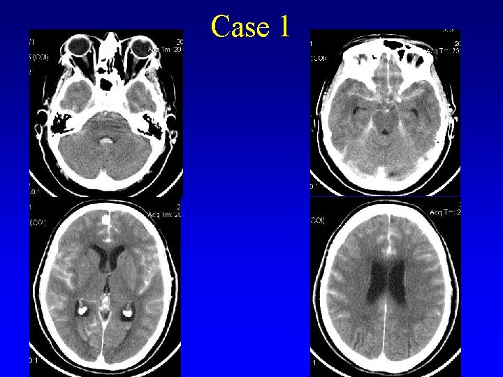 Case 1 
