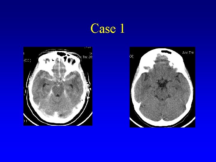 Case 1 