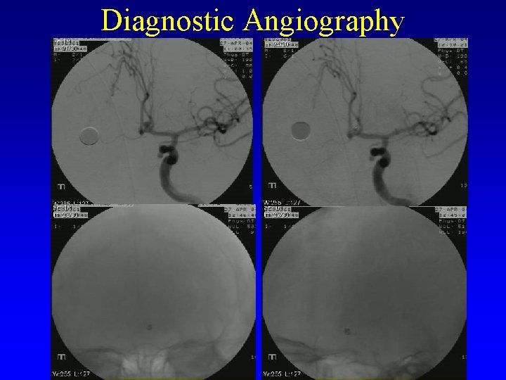 Diagnostic Angiography 