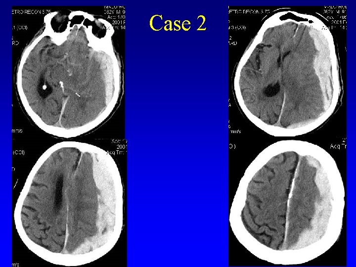 Case 2 