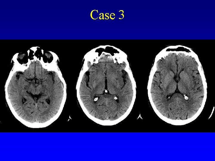 Case 3 