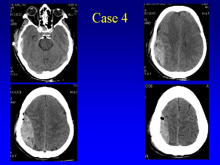 Case 4 