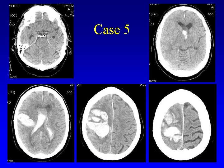 Case 5 