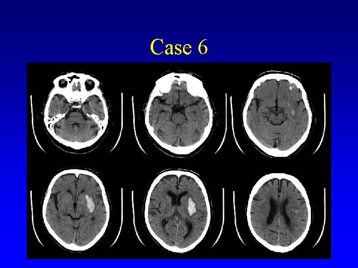 Case 6 • Add htn image here 