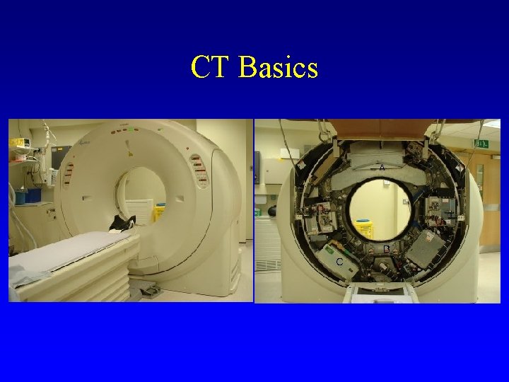 CT Basics 