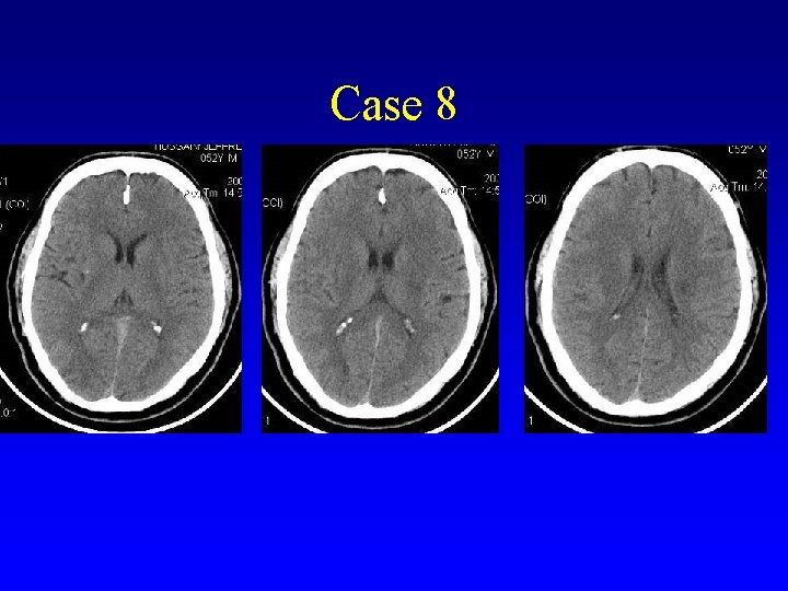 Case 8 